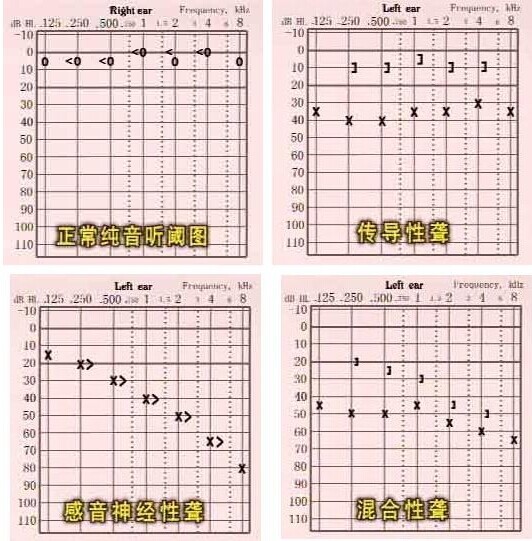 女孩考什么大学适合_读唇语大赛的段子_女孩靠读唇语考大学