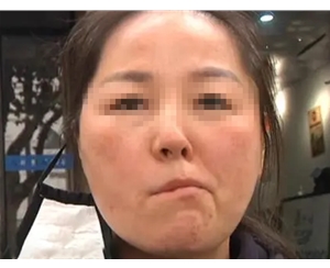 加班熬夜 猝死_熬夜加班发现嘴歪了_梦见别人嘴歪脸歪好了