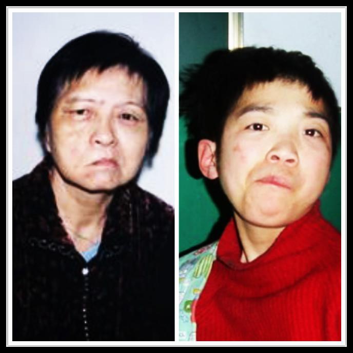 梦见别人嘴歪脸歪好了_加班熬夜 猝死_熬夜加班发现嘴歪了