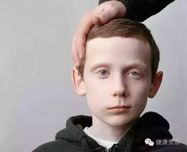 熬夜加班发现嘴歪了_梦见别人嘴歪脸歪好了_加班熬夜 猝死