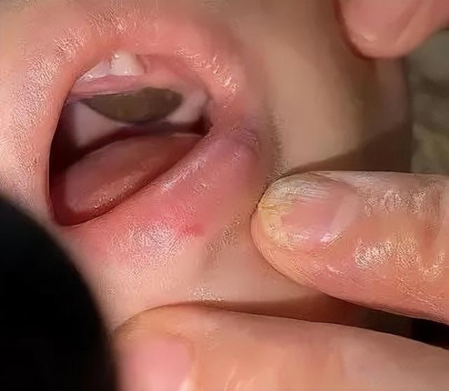 福州大学回应准研究生疑似虐狗_当事医生回应莲子壳诊断为疑似肿瘤_警方回应疑似未成年女孩嫁中年男子