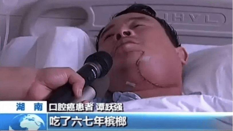 香港拟全面禁售电子烟等另类吸烟产品_义乌拟永久禁售槟榔_义乌永久脱毛满意欧莱美