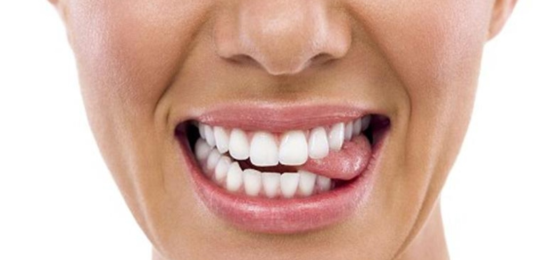 大连一孕妇感染新冠后诞下男婴_伊朗第一副总统确诊感染新冠病毒_感染新冠后牙齿变黑