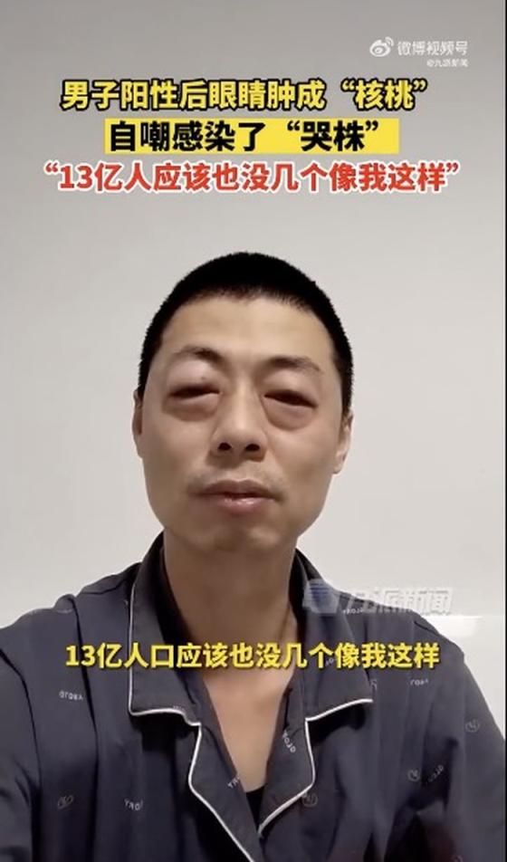 大连一孕妇感染新冠后诞下男婴_伊朗第一副总统确诊感染新冠病毒_感染新冠后牙齿变黑