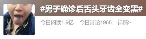 戴烤瓷冠套后感觉牙齿软软的_感染新冠后牙齿变黑_法国文化部长确诊感染新冠肺炎