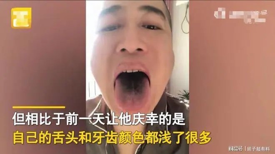 法国文化部长确诊感染新冠肺炎_戴烤瓷冠套后感觉牙齿软软的_感染新冠后牙齿变黑