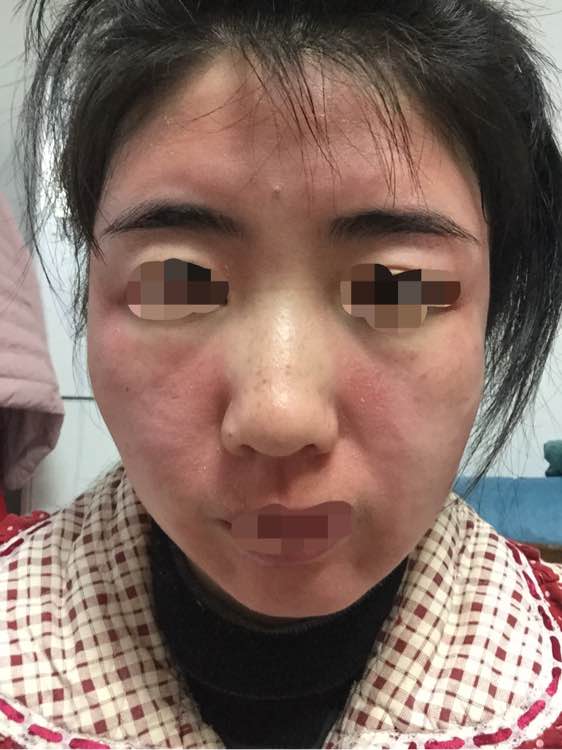 身边没有无症状感染者?张文宏:瞎说_感染幽门螺杆菌的症状有口臭这_鲁有兀者叔山无趾