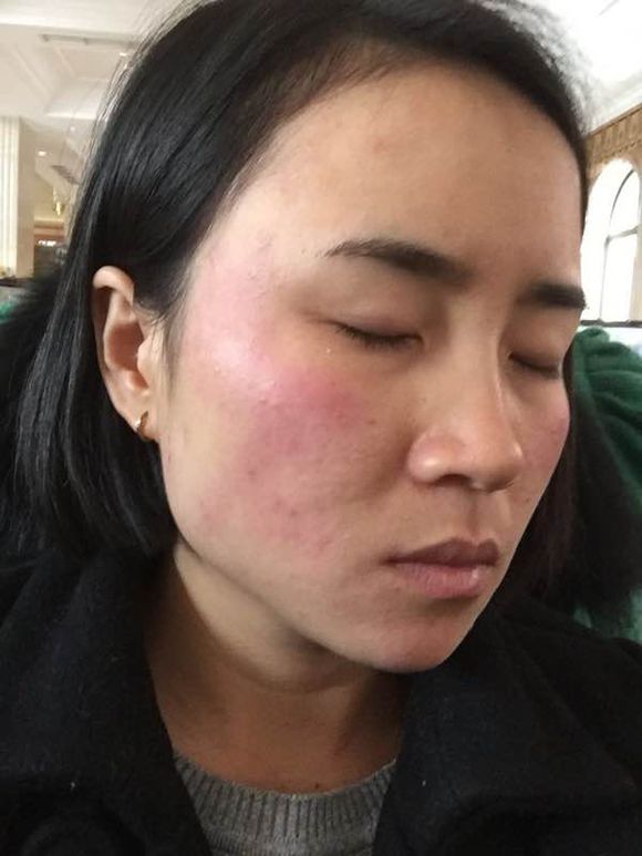 鲁有兀者叔山无趾_身边没有无症状感染者?张文宏:瞎说_感染幽门螺杆菌的症状有口臭这