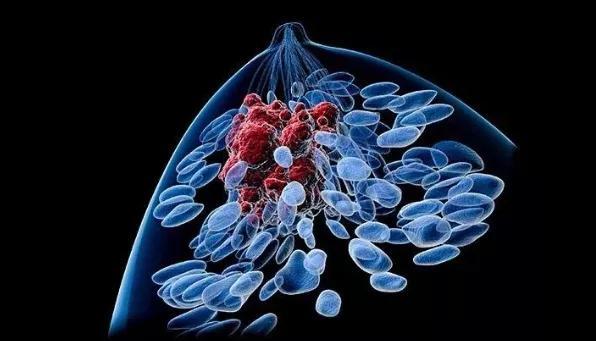 乳腺导管癌与小叶癌区别_测癌试纸最早被用于哪种癌症的测试?_乳腺癌成第一大癌症