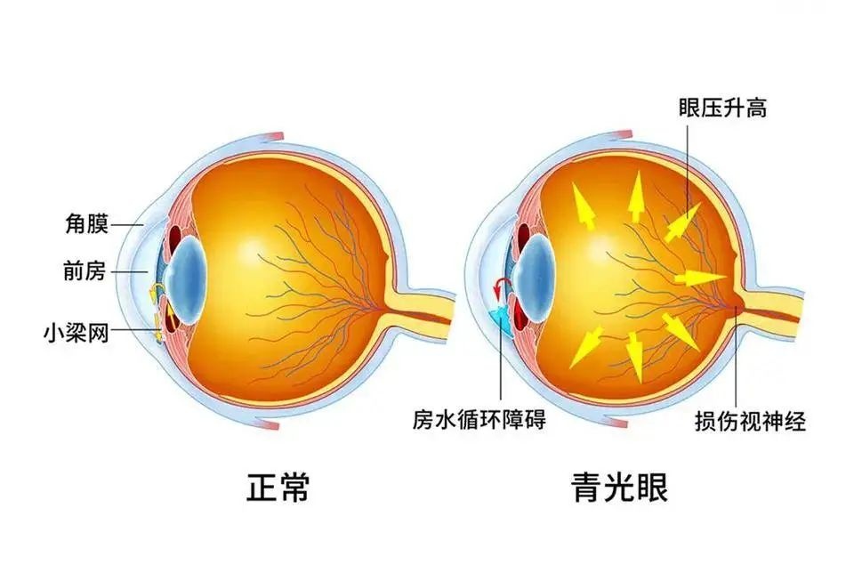 千万不要侧躺玩手机_侧切线头不吸收要拽出来吗_泽叶蓁蓁嫡女侧妃要翻墙